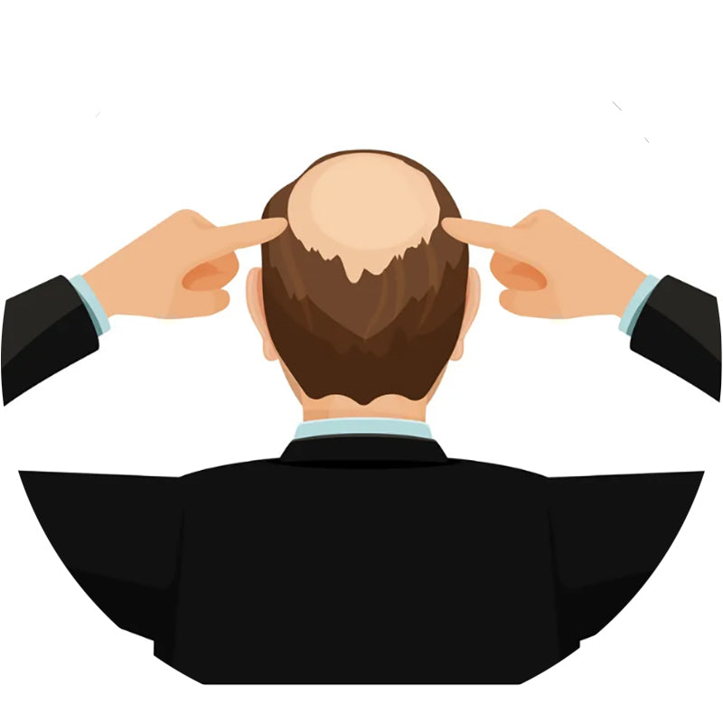 Hair Loss