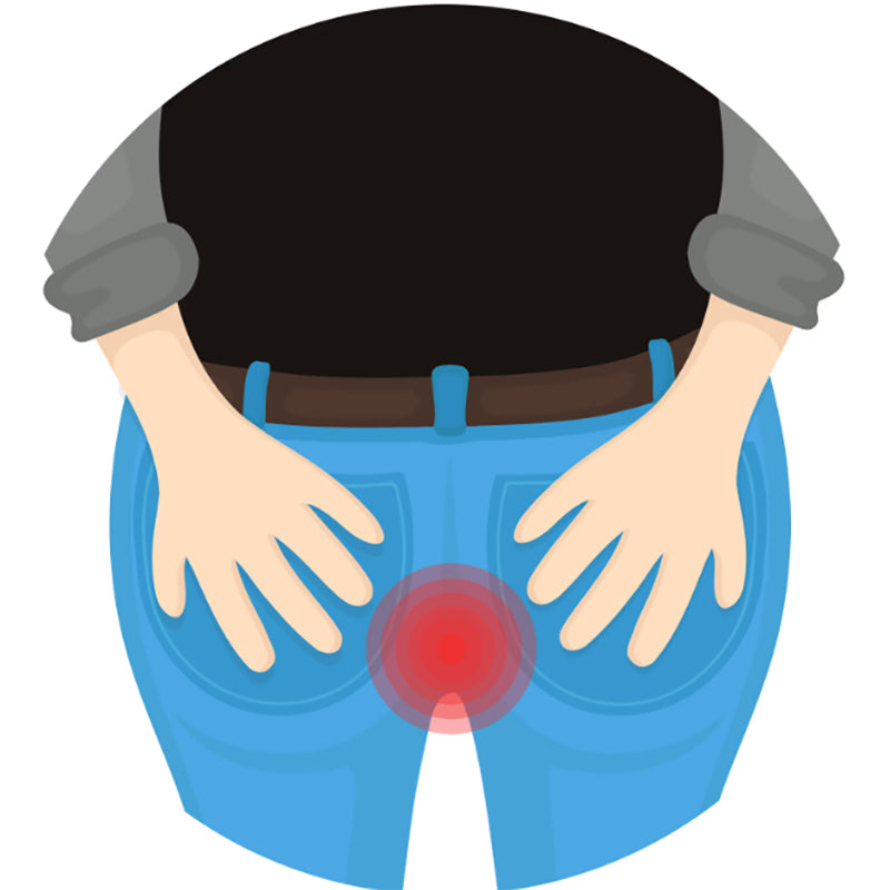 Hemorrhoids