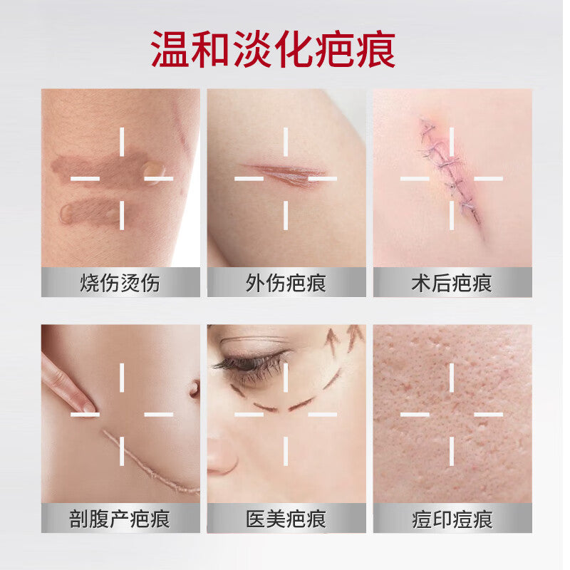 丹芎瘢痕涂膜, Danxiong Banhen Tumo, Dan Xiong Ban Hen Tu Mo, 20g, Effective Scar Reduction & Treatment Aid for Hyperplasia After Burn & Scald Healing