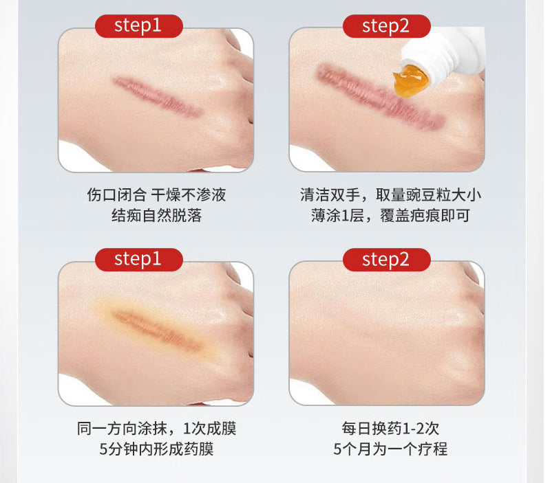 丹芎瘢痕涂膜, Danxiong Banhen Tumo, Dan Xiong Ban Hen Tu Mo, 20g, Effective Scar Reduction & Treatment Aid for Hyperplasia After Burn & Scald Healing