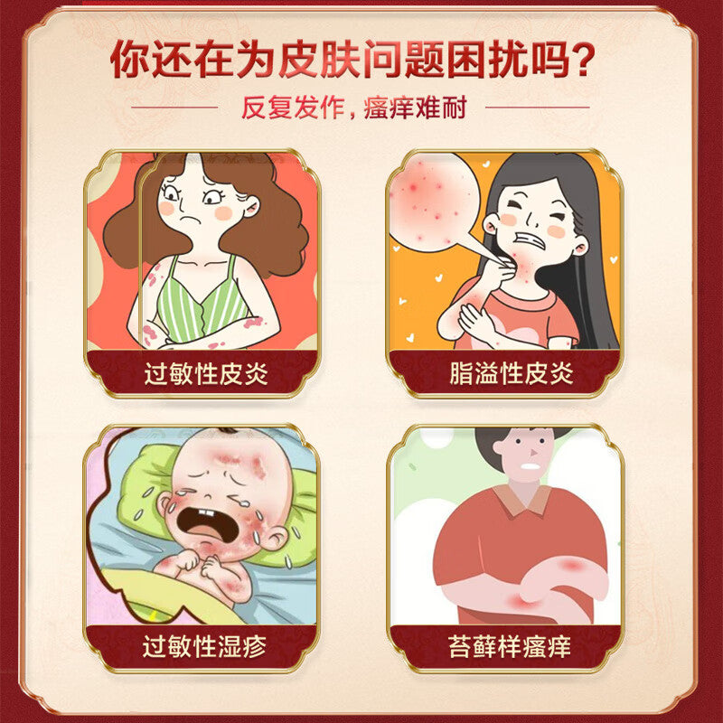 尤卓尔 丁酸氢化可的松乳膏, Hydrocortisone Butyrate Cream, 20mg