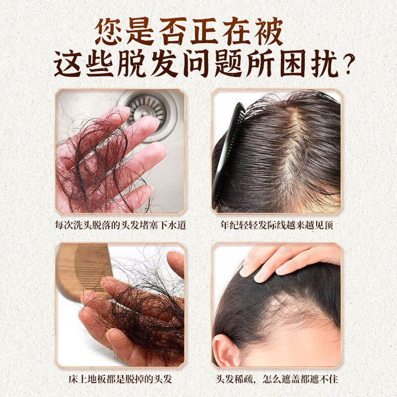 固肾生发丸, Gushen Shengfa Wan, for Alopecia Areata, Alopecia Totalis, Alopecia Universalis, and Hair Loss Due to Liver and Kidney Deficiency